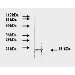 AM09159PU-N