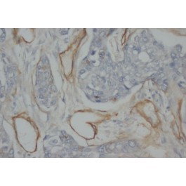 AM20613PU-N
