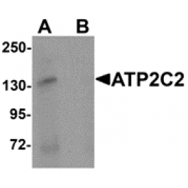 AP26125CP-N