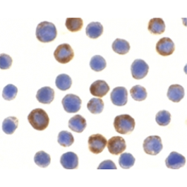 SP1414P