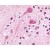 Formalin-Fixed, Paraffin-Embedded Human Brain, Neurons and Glia stained with BDKRB2 Antibody Cat.-No SP4078P after heat-induced antigen retrieval.