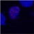 Figure 1C: Merged figures A and B - confirmation of nuclear localization of the fusion protein (cell nuclei stained with DAPI (blue).