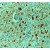 Formalin fixed paraffin embedded human astrocytoma stained with GFAP antibody DP014 / DP014-05
