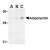 Western blot analysis of adiponectin in rat brain cell lysate with adiponectin antibody at (A) 1, (B) 2, and (C) 4 µg/ml.