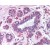 Breast: Formalin-Fixed Paraffin-Embedded (FFPE)