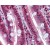 Small intestine: Formalin-Fixed Paraffin-Embedded (FFPE)