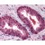 Prostate: Formalin-Fixed Paraffin-Embedded (FFPE)