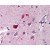 Brain, cortex: Formalin-Fixed Paraffin-Embedded (FFPE)