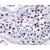 Testis: Formalin-Fixed Paraffin-Embedded (FFPE)