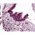 AP07559PU-N AP3D1 antibody staining of Formalin-Fixed Paraffin-Embedded Human Lung, Respiratory Epithelium at 2.5 µg/ml