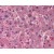 Liver: Formalin-Fixed Paraffin-Embedded (FFPE)