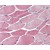 Skeletal muscle: Formalin-Fixed Paraffin-Embedded (FFPE)