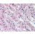 Adrenal: Formalin-Fixed Paraffin-Embedded (FFPE)