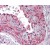 Formalin-Fixed Paraffin-Embedded Human Skeletal muscle, vessel stained with ACTB Antibody Cat.-No AP07540PU-N at 5 µg/ml.