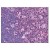 Staining Blooms Syndrome Protein Blm antibody in Thymus by Immunohistochemistry using Formalin-Fixed Paraffin-Embedded (FFPE) tissue.