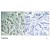 Figure 1. Immunohistochemical analysis of paraffin-embedded human breast carcinoma tissue using PLC-gamma 1 Antibody AP08095PU.