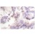 Immunohistochemistry (IHC) analyzes of p15 INK antibody (Cat.-No.: AP06261PU-N)  in paraffin-embedded human lung carcinoma tissue.