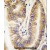 Formalin-fixed and paraffin-embedded human lung carcinoma tissue reacted with PTEN antibody (N-term) Cat.-No AP15248PU-N which was peroxidase-conjugated to the secondary antibody, followed by DAB staining.