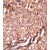 Formalin-fixed and paraffin-embedded human cancer tissue reacted with the primary antibody, which was peroxidase-conjugated to the secondary antibody, followed by AEC staining