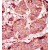 Formalin-fixed and paraffin-embedded human cancer tissue reacted with the primary antibody, which was peroxidase-conjugated to the secondary antibody, followed by AEC staining.