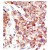 Formalin-fixed and paraffin-embedded human cancer tissue reacted with the primary antibody, which was peroxidase-conjugated to the secondary antibody, followed by DAB staining. This data demonstrates the use of this antibody for immunohistochemistry; clinical relevance has not been evaluated.