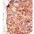 Formalin-fixed and paraffin-embedded human cancer tissue reacted with the primary antibody, which was peroxidase-conjugated to the secondary antibody, followed by DAB staining. This data demonstrates the use of this antibody for immunohistochemistry; clinical relevance has not been evaluated.