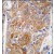 Formalin-fixed and paraffin-embedded human hepatocarcinoma tissue reacted with AP14685PU-N ALDH1L1 antibody (C-term), which was peroxidase-conjugated to the secondary antibody, followed by DAB staining.