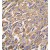 Formalin-fixed and paraffin-embedded human lung carcinoma tissue reacted with ALDH3A1 antibody (Center), which was peroxidase-conjugated to the secondary antibody, followed by DAB staining.