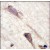 Formalin-fixed and paraffin-embedded human brain tissue reacted with BRAF Antibody (S601), which was peroxidase-conjugated to the secondary antibody, followed by DAB staining.