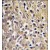 AP14221PU-N CYP19A1 antibody staining of Formalin-Fixed, Paraffin-Embedded Human placenta tissue using peroxidase-conjugate and DAB chromogen.