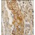 Formalin-fixed and paraffin-embedded human lung carcinoma tissue reacted with ACPP antibody (C-term), which was peroxidase-conjugated to the secondary antibody, followed by DAB staining.