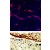 TOP: Methanol/Acetone fixed human stem cell is used in IF to detect Eph4A (blue) and endothelial Lectin(red). Data kindly provided by Dr. Weis from Cheresh Lab, UCSD. BOTTOM:Formalin-fixed and paraffin-embedded human cancer tissue reacted with the primary antibody, which was peroxidase-conjugated to the secondary antibody, followed by DAB staining.