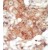 Formalin-fixed and paraffin-embedded human cancer tissue reacted with the primary antibody, which was peroxidase-conjugated to the secondary antibody, followed by DAB staining.