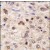 Formalin-fixed and paraffin-embedded human hepatocarcinoma tissue reacted with ZBTB7B antibody (Center), which was peroxidase-conjugated to the secondary antibody, followed by DAB staining.