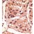 Formalin-fixed and paraffin-embedded human cancer tissue reacted with the primary antibody, which was peroxidase-conjugated to the secondary antibody, followed by DAB staining.