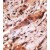 Formalin-fixed and paraffin-embedded human cancer tissue reacted with the primary antibody, which was peroxidase-conjugated to the secondary antibody, followed by AEC staining.