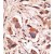 Formalin-fixed and paraffin-embedded human cancer tissue reacted with the primary antibody, which was peroxidase-conjugated to the secondary antibody, followed by DAB staining.