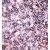 Formalin-fixed and paraffin-embedded human cancer tissue reacted with the primary antibody, which was peroxidase-conjugated to the secondary antibody, followed by AEC staining.