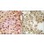 (LEFT)Formalin-fixed and paraffin-embedded human cancer tissue reacted with the primary antibody, which was peroxidase-conjugated to the secondary antibody, followed by AEC staining. (RIGHT)Formalin-fixed and paraffin-embedded human testis tissue reacted with ACE2 (SARS Receptor) Antibody (N-term), which was peroxidase-conjugated to the secondary antibody, followed by DAB staining.