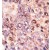 Formalin-fixed and paraffin-embedded human cancer tissue reacted with the primary antibody, which was peroxidase-conjugated to the secondary antibody, followed by DAB staining.