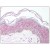 Skin: Formalin-Fixed Paraffin-Embedded (FFPE)
