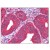 Uterus: Formalin-Fixed Paraffin-Embedded (FFPE)