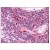 Thymus: Formalin-Fixed Paraffin-Embedded (FFPE)