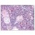 Thymus: Formalin-Fixed Paraffin-Embedded (FFPE)