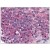 Spleen: Formalin-Fixed Paraffin-Embedded (FFPE)