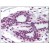 Breast: Formalin-Fixed Paraffin-Embedded (FFPE)