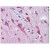 Brain, cortex: Formalin-Fixed Paraffin-Embedded (FFPE)