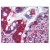 Small intestine: Formalin-Fixed Paraffin-Embedded (FFPE)