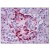 Pancreas: Formalin-Fixed Paraffin-Embedded (FFPE) using EPHA2 antibody