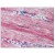 Skeletal muscle: Formalin-Fixed Paraffin Embedded (FFPE)